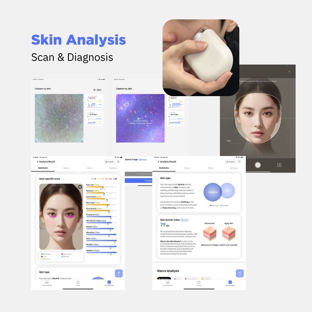 Wireless Ai Scalp Scanner