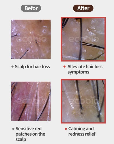 EHPlus Scaling Gel Depecia
