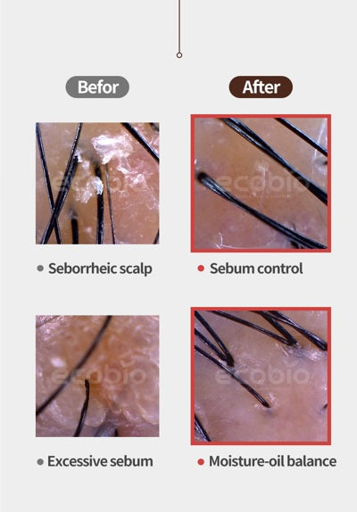 EHPlus Scaling Gel Oily Complex