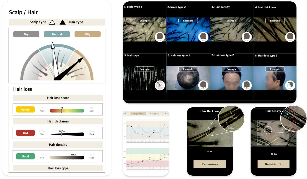 Wired Scalp Microscopic Scanner (CRM Ai Analysis)