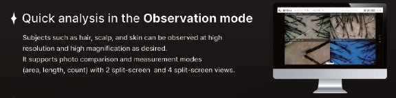 Wired Scalp Microscopic Scanner (CRM Ai Analysis)