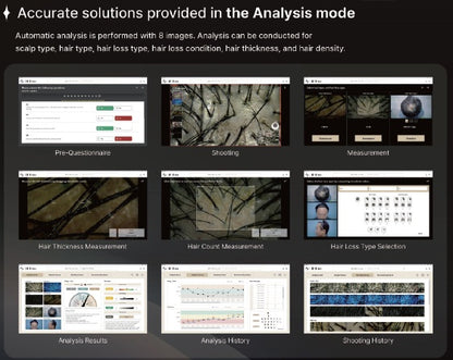 Wired Scalp Microscopic Scanner (CRM Ai Analysis)