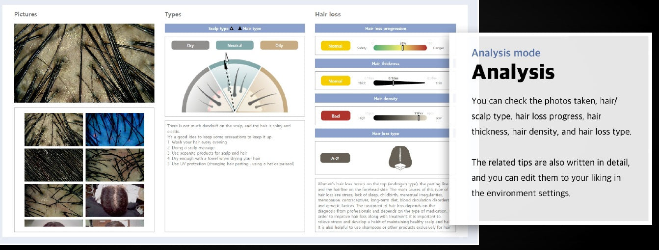 Wired Scalp Microscopic Scanner (CRM Ai Analysis)