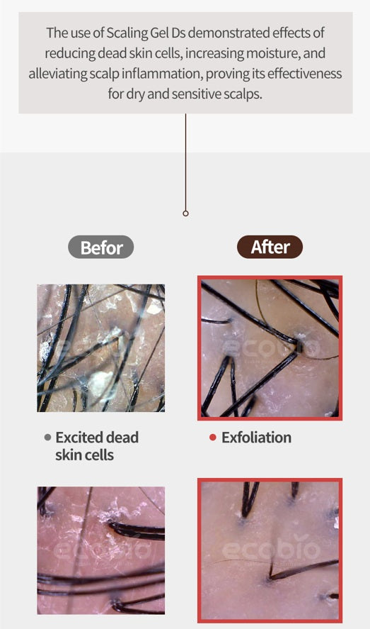 EHPlus Scaling Gel Dry Sensitive