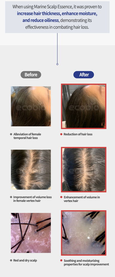 EHPlus Marine Scalp Essence