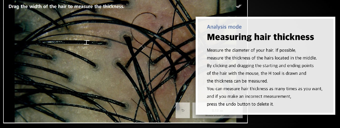 Wired Scalp Microscopic Scanner (CRM Ai Analysis)