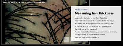 Wired Scalp Microscopic Scanner (CRM Ai Analysis)