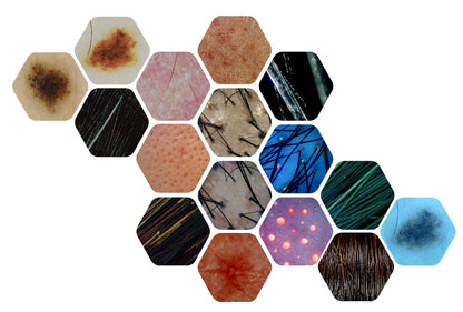 Wired Scalp Microscopic Scanner (CRM Ai Analysis)