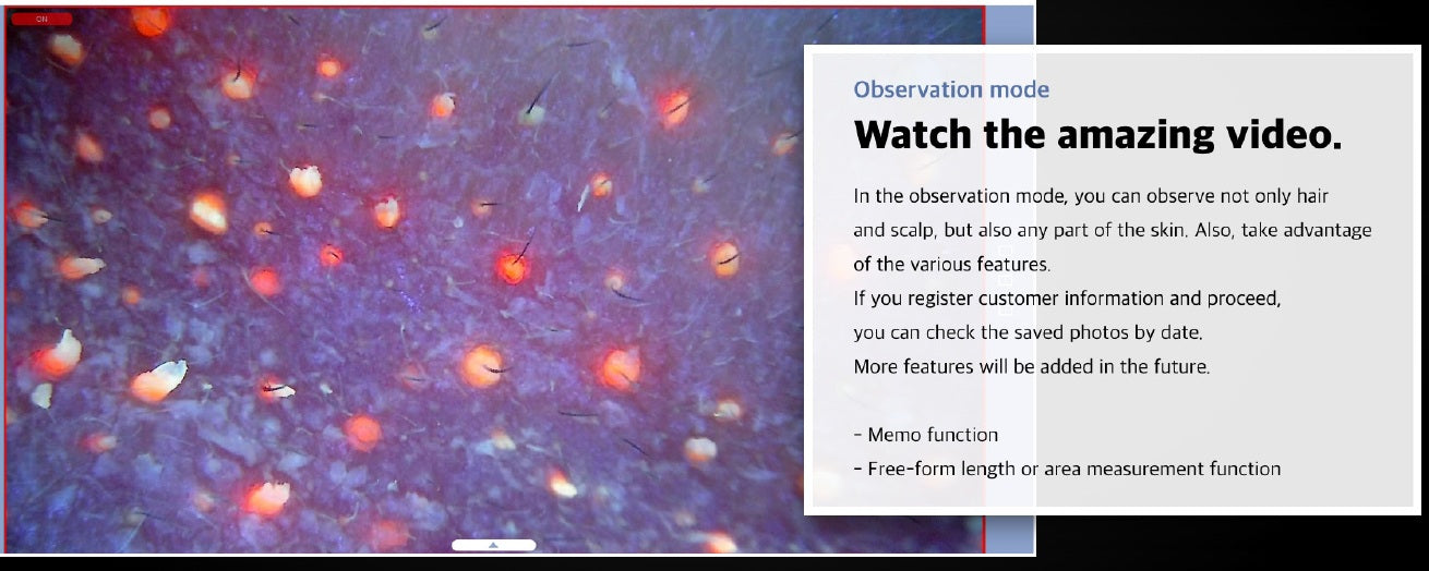 Wired Scalp Microscopic Scanner (CRM Ai Analysis)