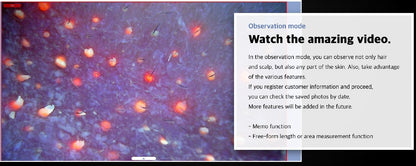 Wired Scalp Microscopic Scanner (CRM Ai Analysis)