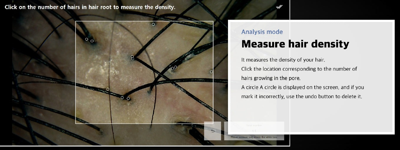 Wired Scalp Microscopic Scanner (CRM Ai Analysis)